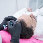 Adult male person receiving injection in his head