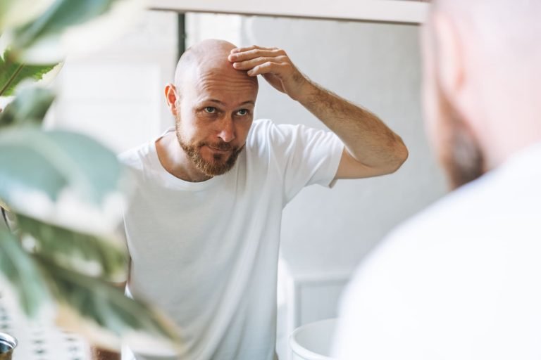 young-adult-bearded-man-looking-mirror-bathroom-touching-head-worried-about-about-hair-loss-1-1-1-768x512