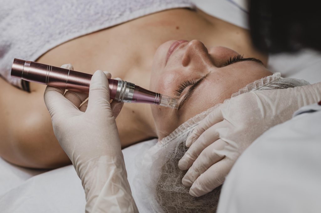 EL CURSO DE DERMAPEN Y MICRONEEDLING QUE LOS SANITARIOS Y PROFESIONALES DE LA ESTÉTICA NECESITAN DOMINAR