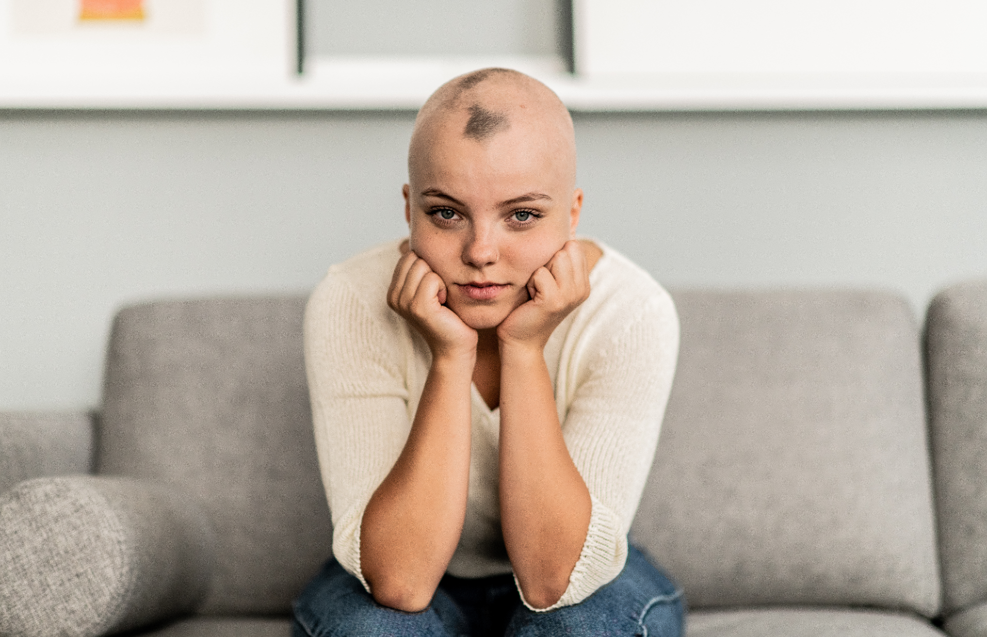 Cuidado especializado del cuero cabelludo